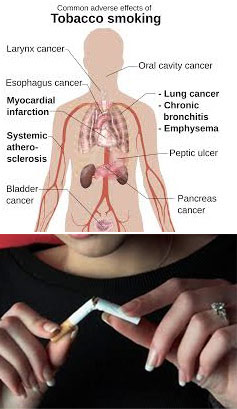 anti_tobacco_movement1